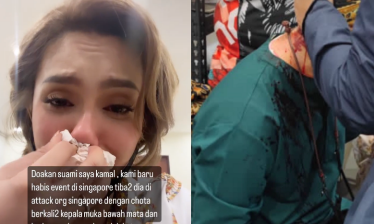 Kamal Adli Cedera Parah Diserang Lelaki Tak Dikenali