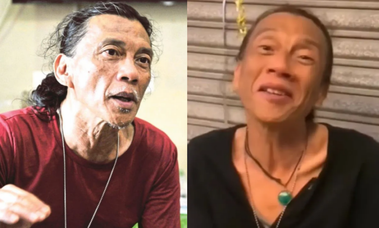 Yantzen Alami Penyakit Misteri, Enam Bulan Tak Tidur